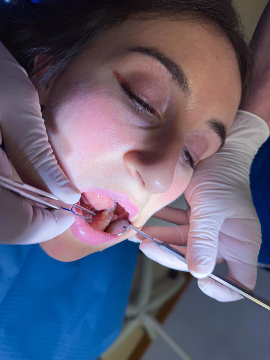 studio-dentistico-dottor-gola-casteggio-odontoiatria-pavia-dentista-implantologia-ortodonzia-protesi-chirurgia-292