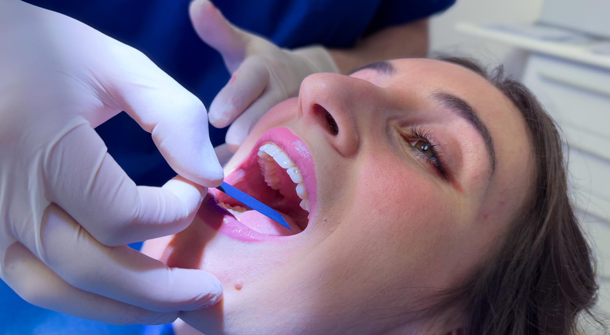 studio-dentistico-dottor-gola-casteggio-odontoiatria-pavia-dentista-implantologia-ortodonzia-protesi-chirurgia-362