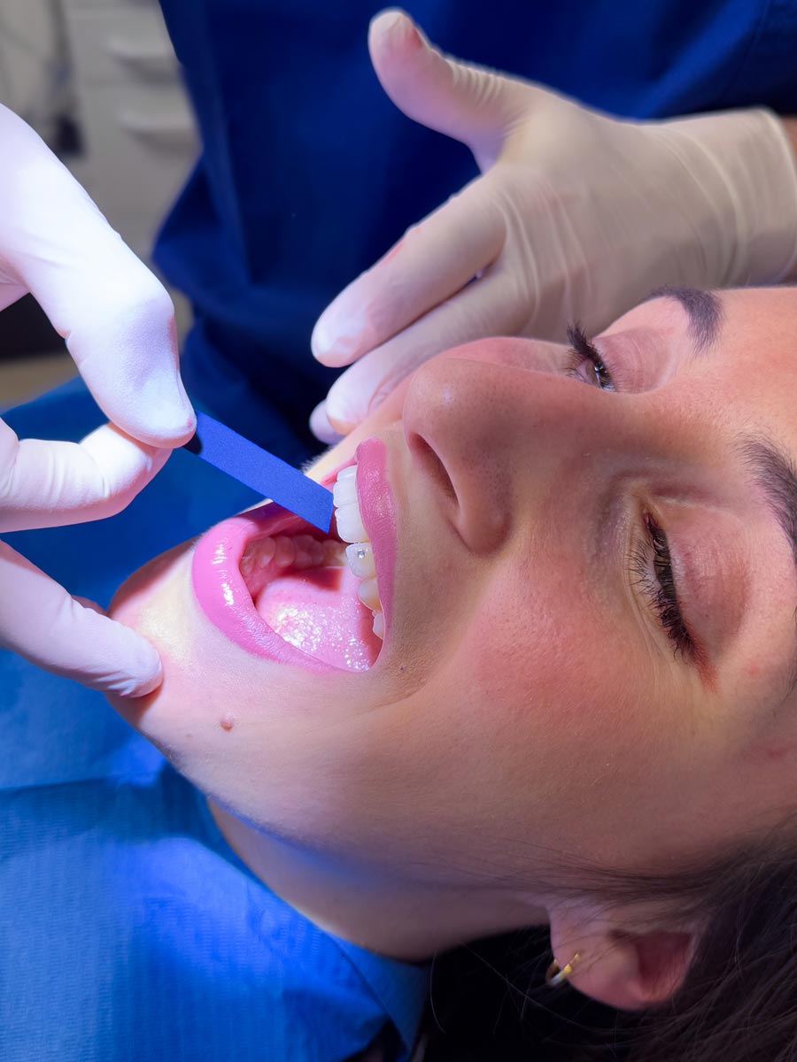 studio-dentistico-dottor-gola-casteggio-odontoiatria-pavia-dentista-implantologia-ortodonzia-protesi-chirurgia-403